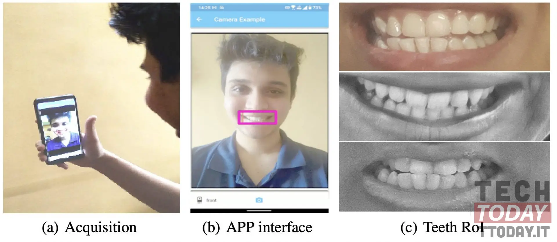 tecnologia di autenticazione tipo face unlock ma con i denti