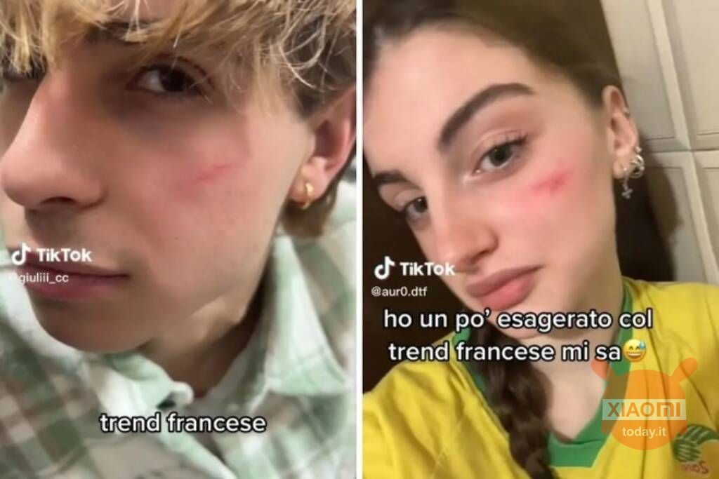 tiktok indagata in italia french scar